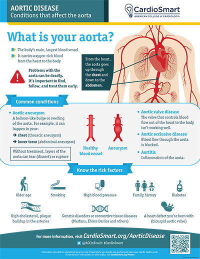 Aortic Disease: What Is Your Aorta? – Infographic | CardioSmart ...