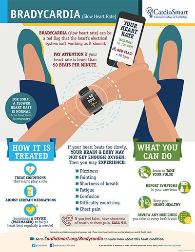 Bradycardia | CardioSmart – American College Of Cardiology