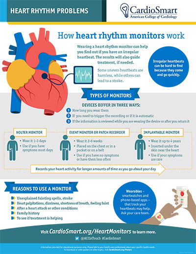 Heart Rhythm Problems | CardioSmart – American College Of Cardiology