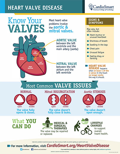 Heart Valve Disease Infographic CardioSmart American College